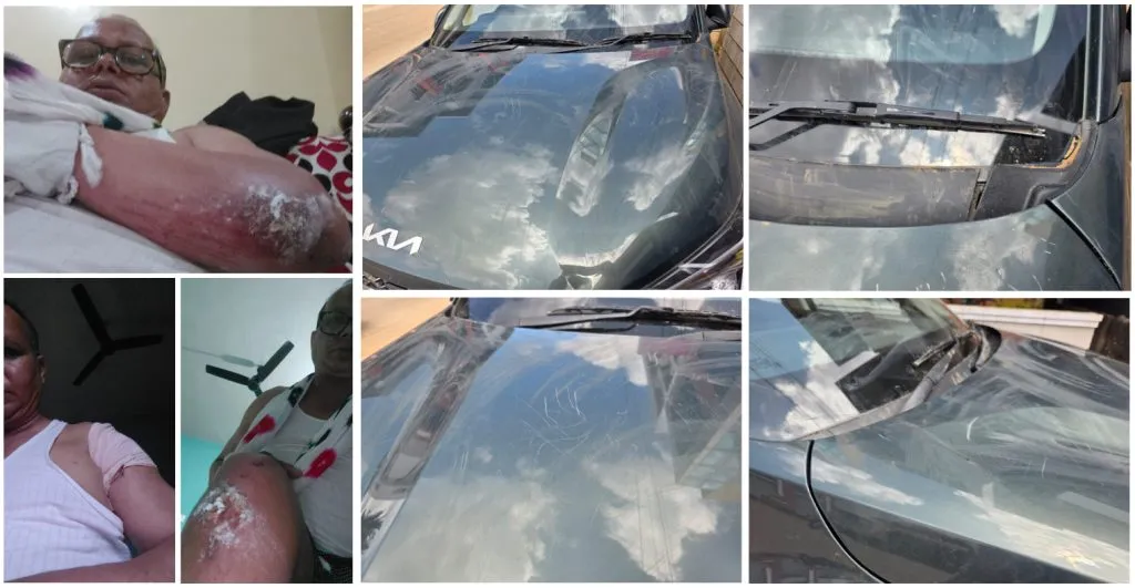 अनगोळ परिसरात रात्री भटक्या कुत्र्यांचा पार्क करून ठेवलेल्या गाड्यांवरही हल्ला Stray dogs also attacked parked cars in the Angol area at night