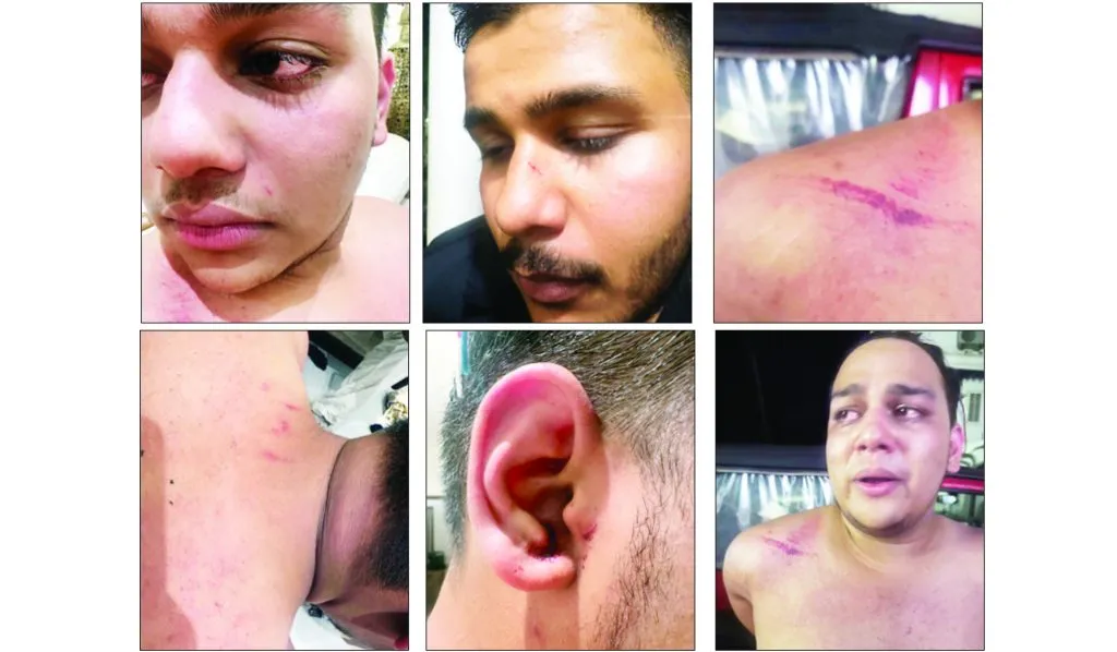 Tourists beaten until they bled