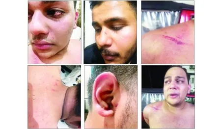 पर्यटकांना रक्तबंबाळ होईपर्यंत मारहाण Tourists beaten until they bled