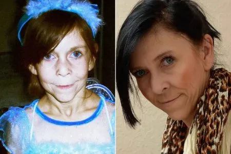 जन्माला येतानाच वृद्धत्व Aging at birth